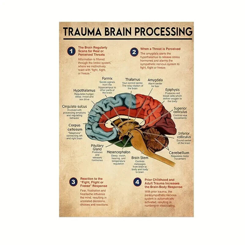 TRAUMA Brain PROCESSING Anatomy Poster Medical Anatomical ChaRT Human DOCTOR GIF